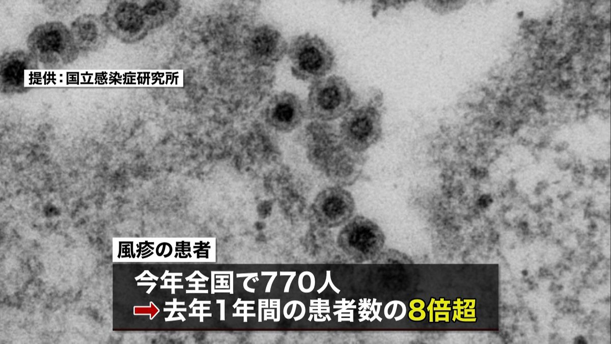 風疹患者が去年比８倍超に　検査を呼びかけ