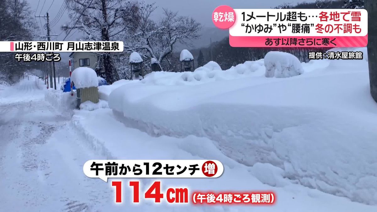 1メートル超も…各地で雪　“かゆみ”や“腰痛”冬の不調感じる人も　12日以降さらに寒く