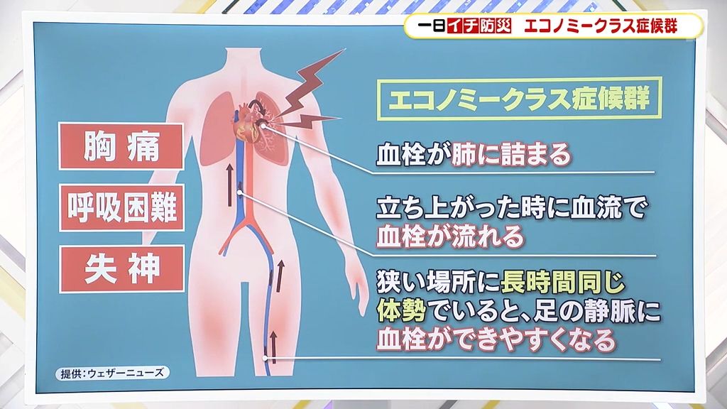 【一日イチ防災】「エコノミークラス症候群」　危険性や予防法を防災士資格を持つアナウンサーが解説