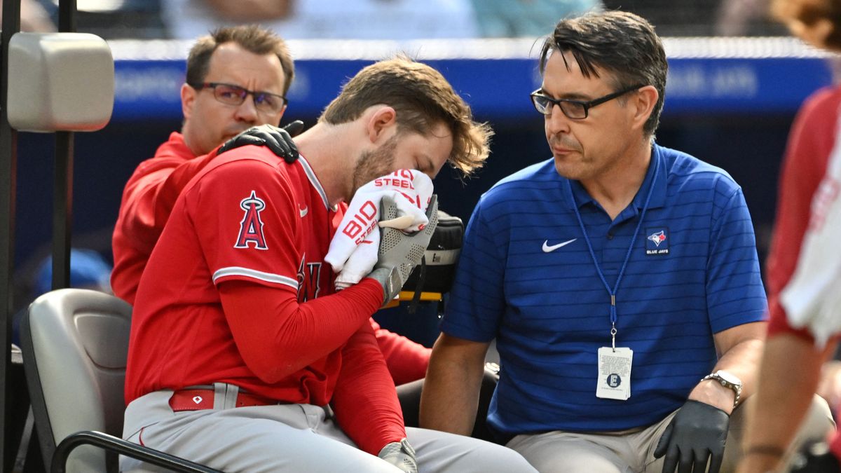 顔面死球を受け負傷交代するエンゼルスのウォード選手(写真:USA TODAY Sports/ロイター/アフロ)