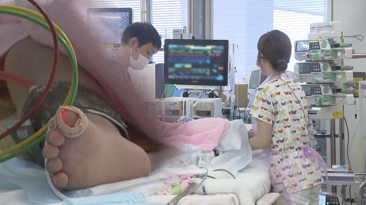 子どもの命を守る“最後の砦”　小児集中治療室「ＰＩＣＵ」に密着　広い北海道に唯一の施設