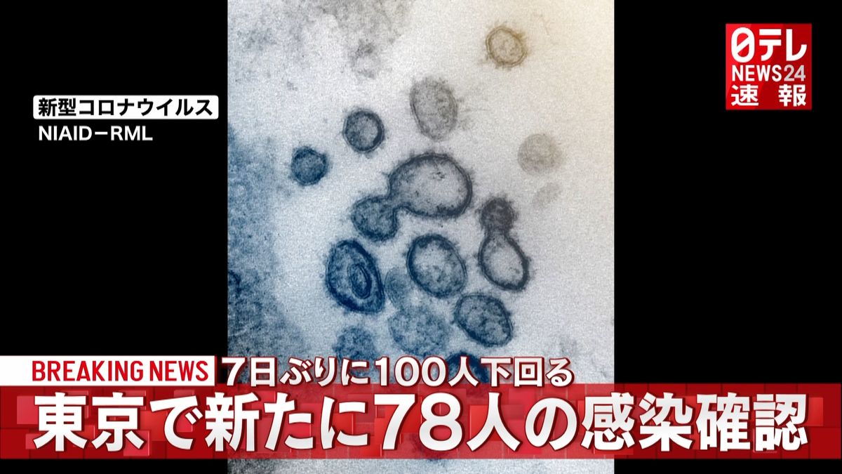 東京で７８人感染　７日ぶり１００人下回る