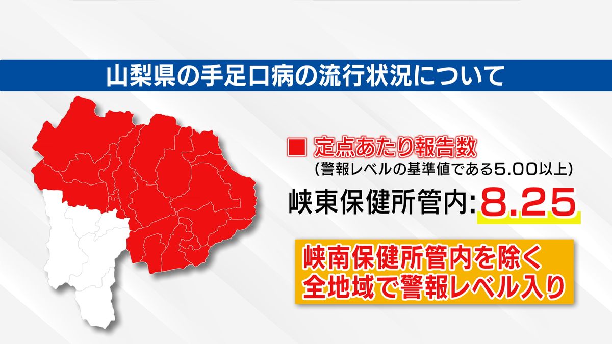 「手足口病」峡東でも警報レベルに ほぼ全域に感染拡大 手洗いなど対策の徹底を 山梨県