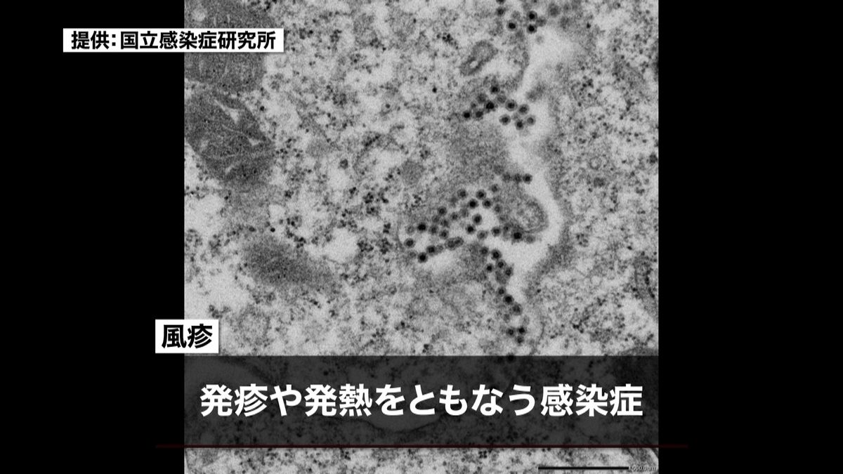 「風疹患者」が大幅増加　感染拡大の恐れ