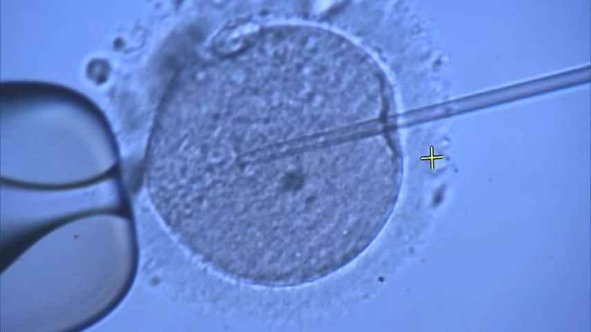 顕微授精で卵に精子を入れる