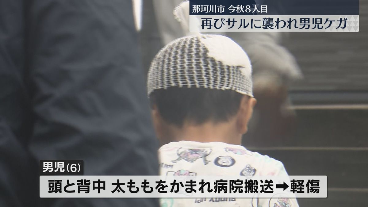 またサルの被害　怖がってしゃがみ込んだ6歳児襲い　母親「カバン投げた」　福岡県那珂川市