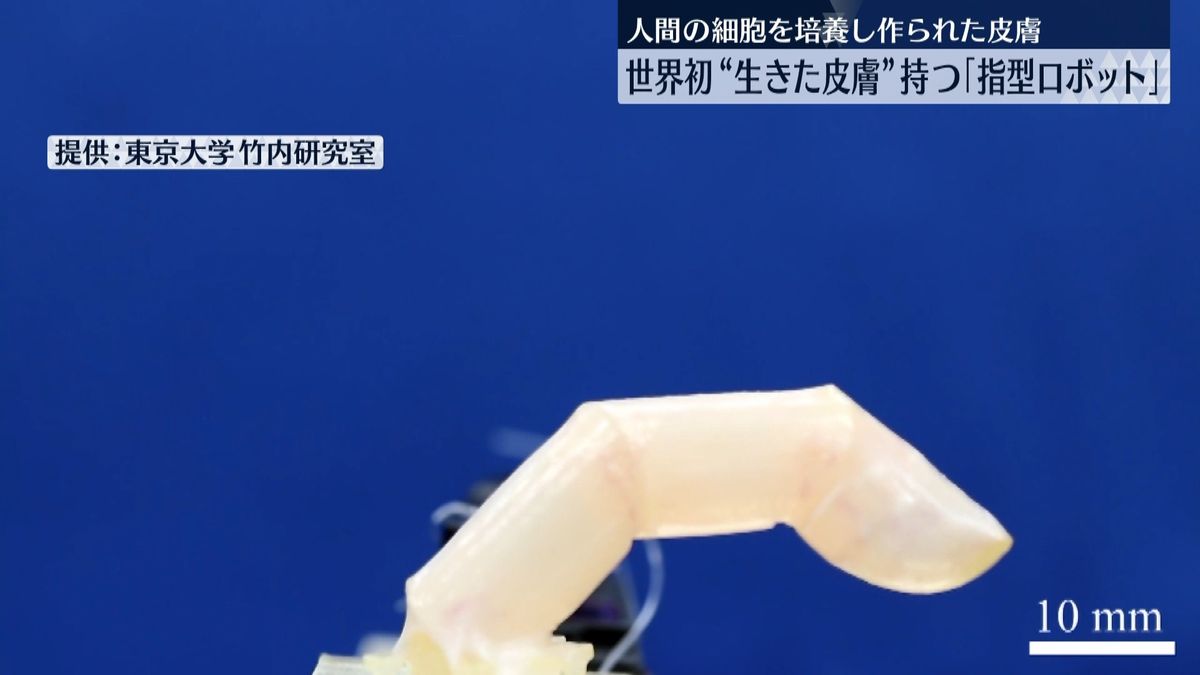 世界初！　“生きた皮膚”持つ指型ロボット開発　傷ができても“自己修復”
