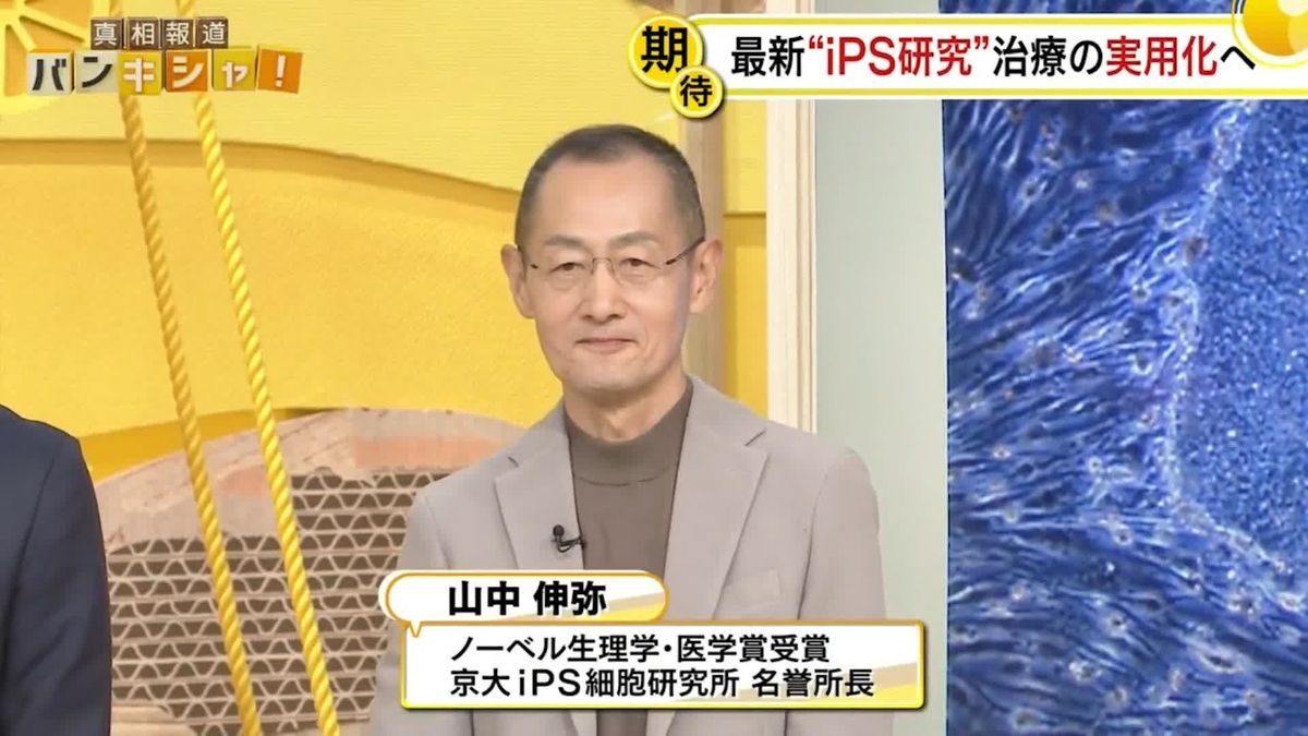 「がん治療」に新たな光も…最新“iPS研究”山中伸弥教授が解説 「my iPS」で拒絶反応と費用の壁解消へ【バンキシャ！】