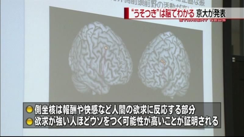 “ウソつき”は脳で分かる…京大研究Ｇ発表