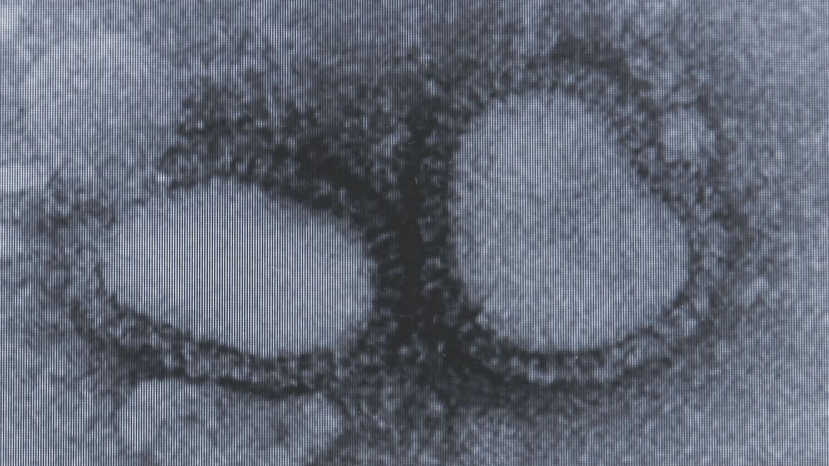 山形県内のインフルエンザ感染者数　前週より増加　12週連続で警報レベル