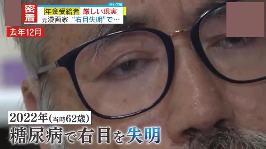 62歳の時、糖尿病で右目を失明