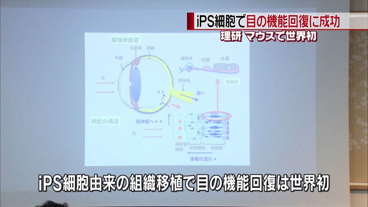 世界初　理研、ｉＰＳ細胞で目の機能回復