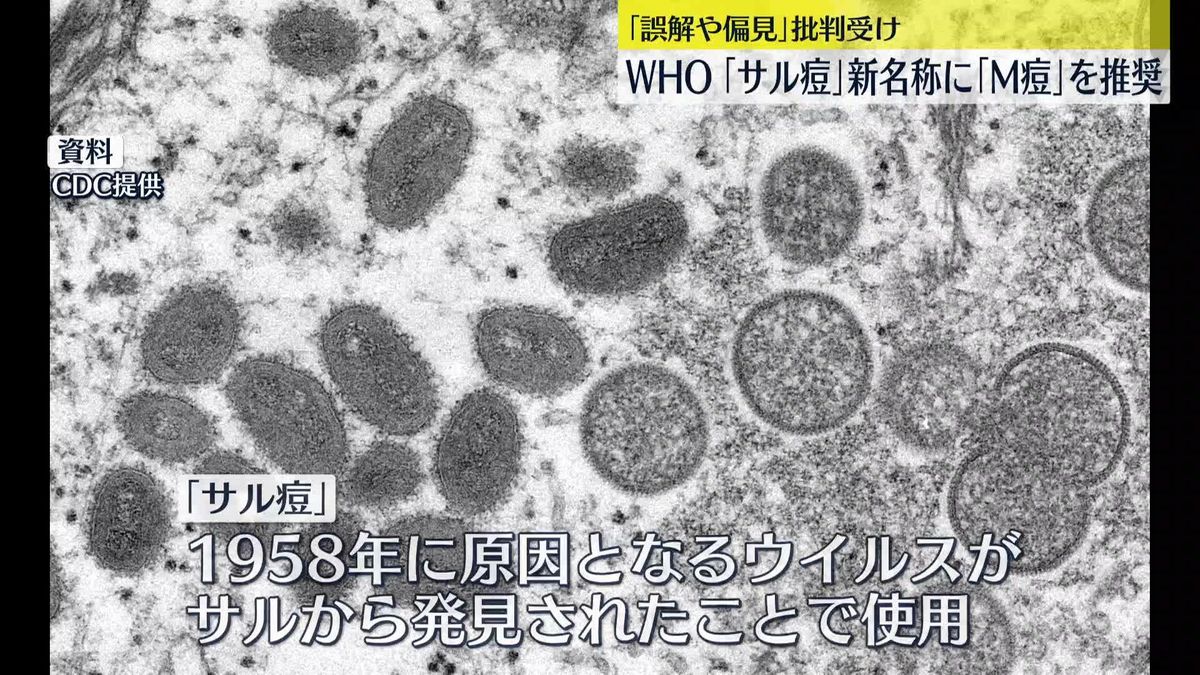 WHO 「サル痘」新名称に「M痘」を推奨と発表　1年間は両方を併用、段階的に「サル痘」の名称を廃止へ