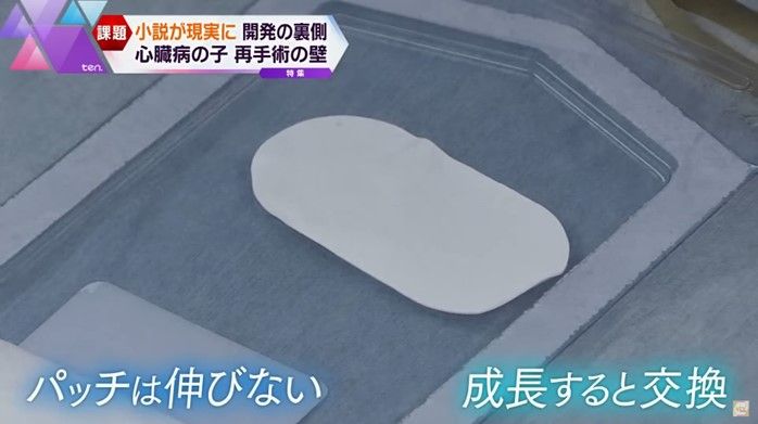 心臓の穴をふさぐ、フッ素樹脂製の「パッチ」