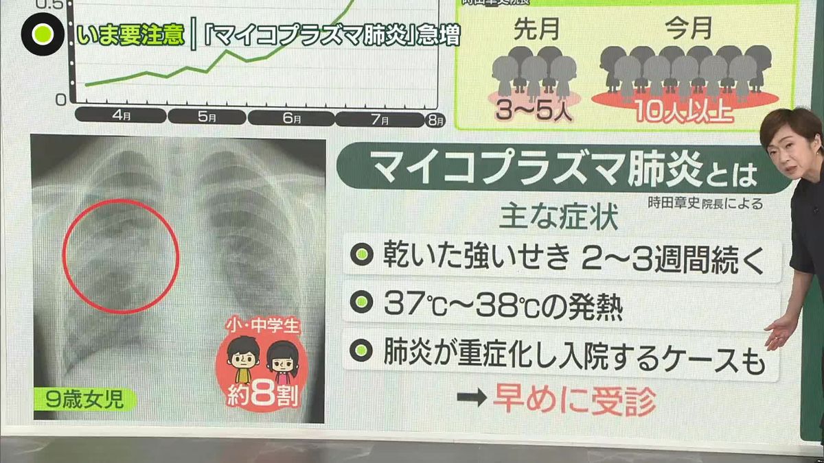 “歩く肺炎”の異名なぜ？ 「マイコプラズマ肺炎」患者が急増、8 年ぶり高水準 報告数は去年の「24 倍」に増加