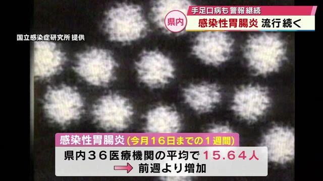 感染性胃腸炎　流行続く　手足口病も警報継続「こまめな手洗いを」大分