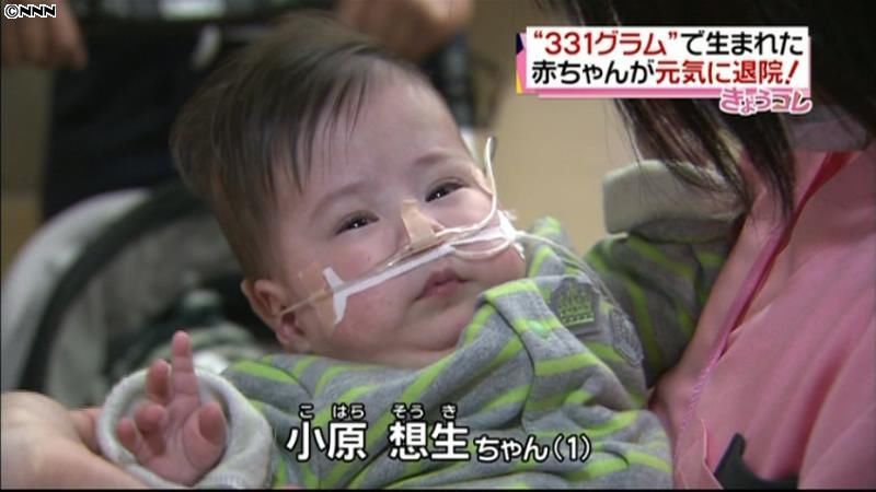 ３３１グラムの赤ちゃん、元気に退院　静岡