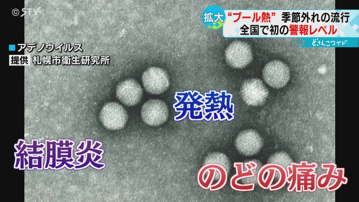 なぜ…「プール熱」警報級の流行　インフルと同時感染も　幼稚園でも収まらず　手洗いが有効