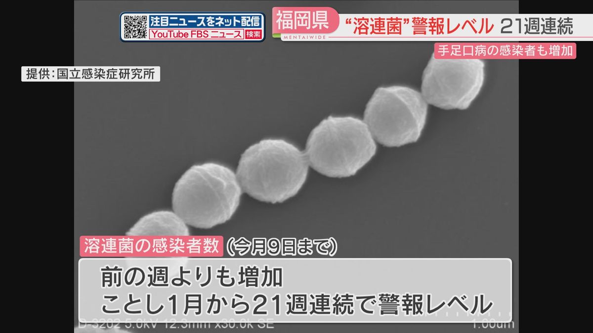 【定点把握】溶連菌が21週連続で「警報レベル」「手足口病」も9週連続で増加　手洗いをしてタオルの共用避けるよう呼びかけ　福岡