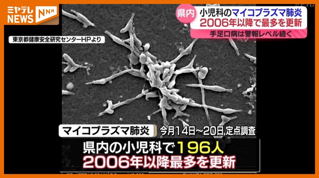 ＜2006年以降で”過去最多”更新＞小児科での「マイコプラズマ肺炎」患者　「手足口病」も依然”警報レベル”（宮城県）