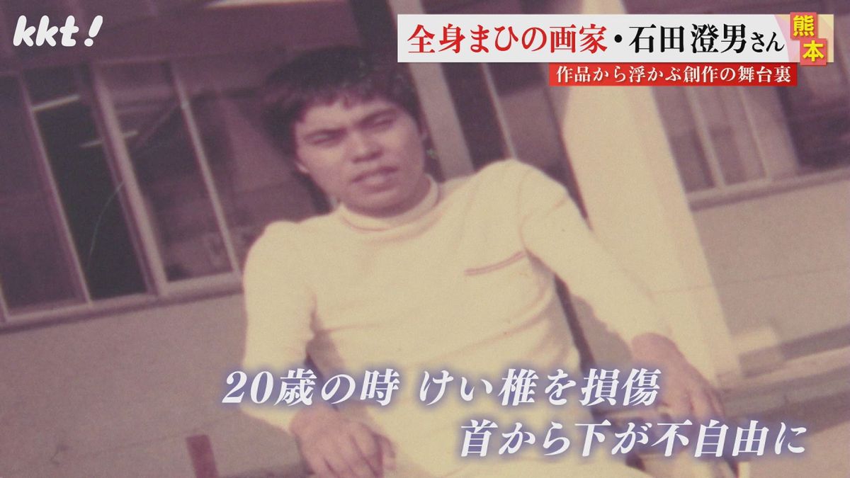石田澄夫さんは事故でけい椎を損傷し首から下が不自由に