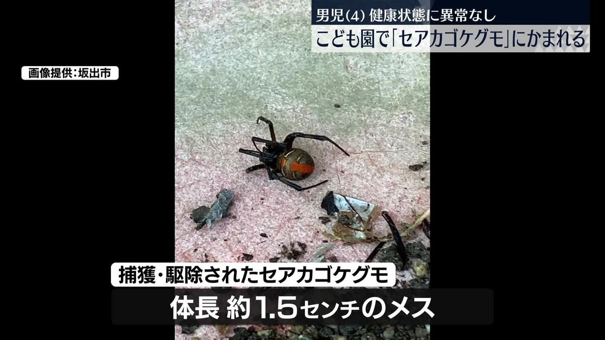 4歳男児が「セアカゴケグモ」にかまれる　健康状態に異常なし　香川・坂出市