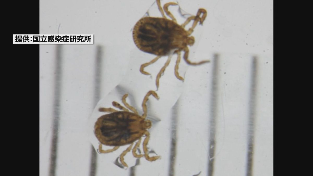 日本紅班熱の患者を確認　鳥取県内で今年1例目　病原体を持ったマダニに刺されると感染