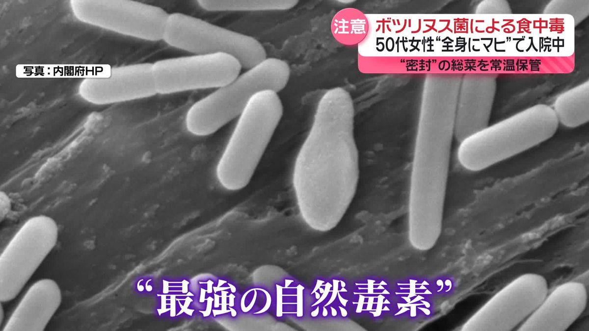 ボツリヌス菌による食中毒…50代女性が全身マヒの症状で入院中　“密封”の総菜を約2か月常温保管