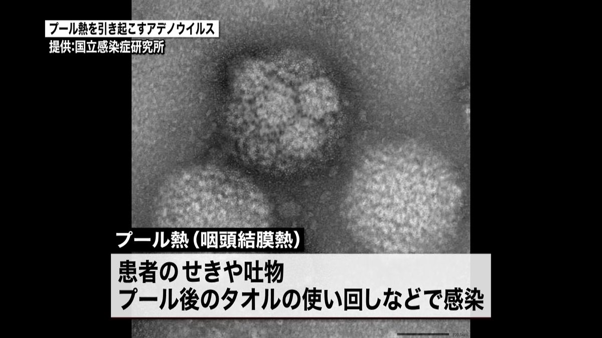 「プール熱」子ども患者、過去１０年で最多