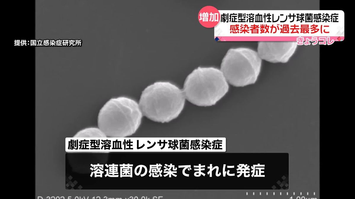 「劇症型溶血性レンサ球菌感染症」感染者数が過去最多に　身体の壊死などを引き起こす