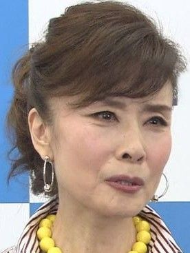 小柳ルミ子 71歳、右手を骨折「顔面から転倒してしまいました」