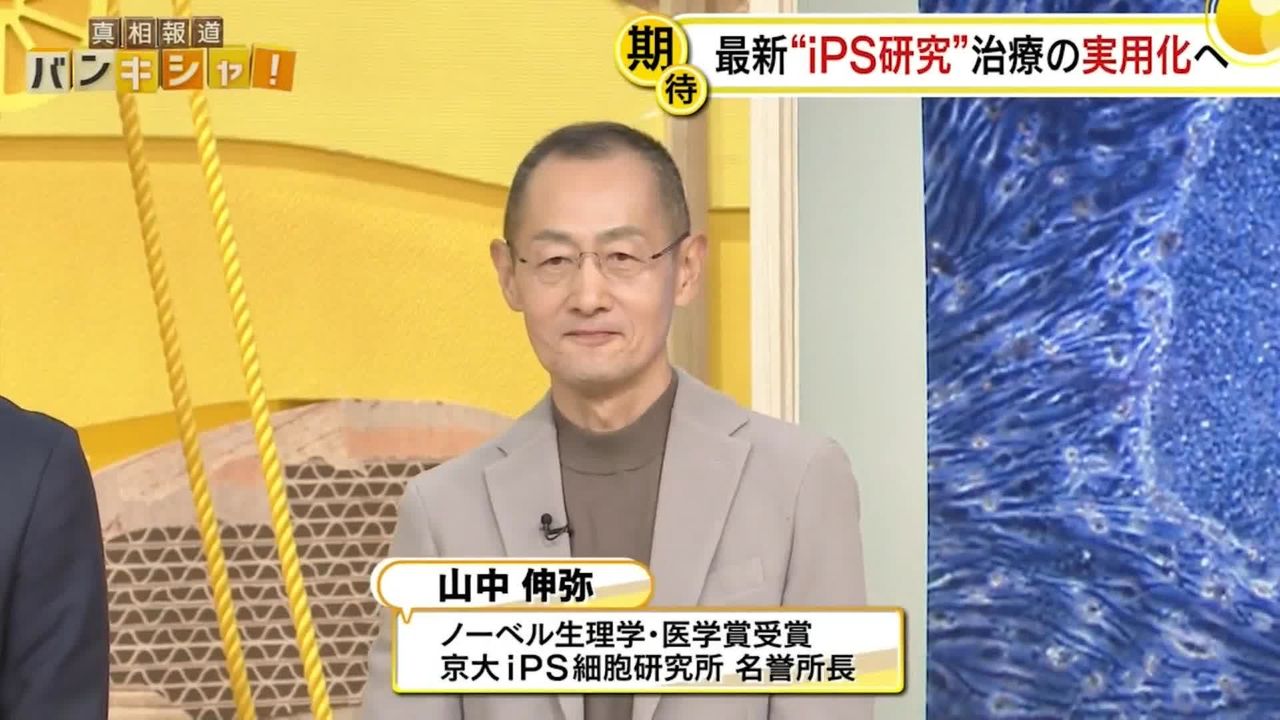 最新“iPS研究”で「がん治療」に新たな光？ 山中伸弥教授が解説【バンキシャ！】（2024年11月24日掲載）｜日テレNEWS NNN