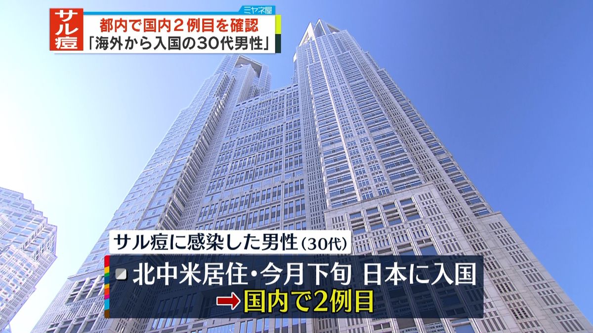 国内2例目「サル痘」感染者確認　北中米に居住の都内30代男性　入国前に感染の疑い　東京都