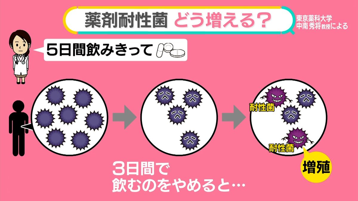 「薬剤耐性菌」増で“サイレントパンデミック”　25年間で死者3900万人超か　どう防ぐ？…自己判断はNG【#みんなのギモン】