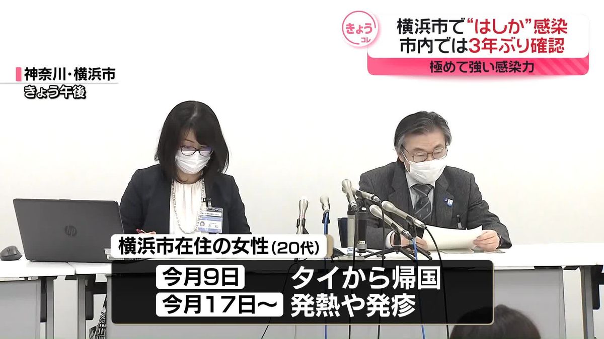 横浜市在住の女性が「はしか」感染　市内では3年ぶり確認