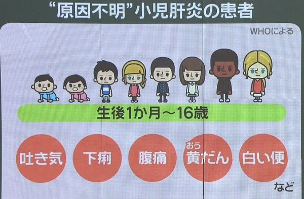 日本では7人の疑い例…症状は？