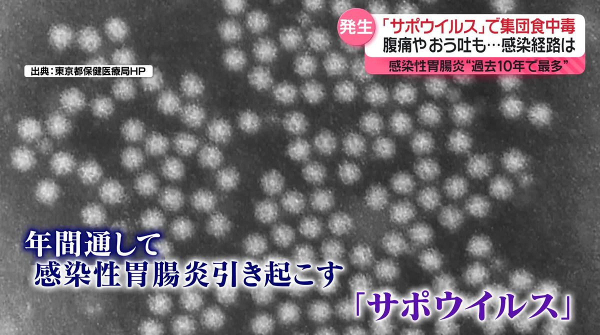 「サポウイルス」で集団食中毒　腹痛やおう吐も…感染経路、対策法は？　ノロウイルスに似た症状