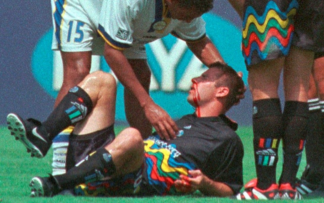 試合中に接触して鼻血を流すバーミリオンさん(1999年　写真:AP/アフロ)