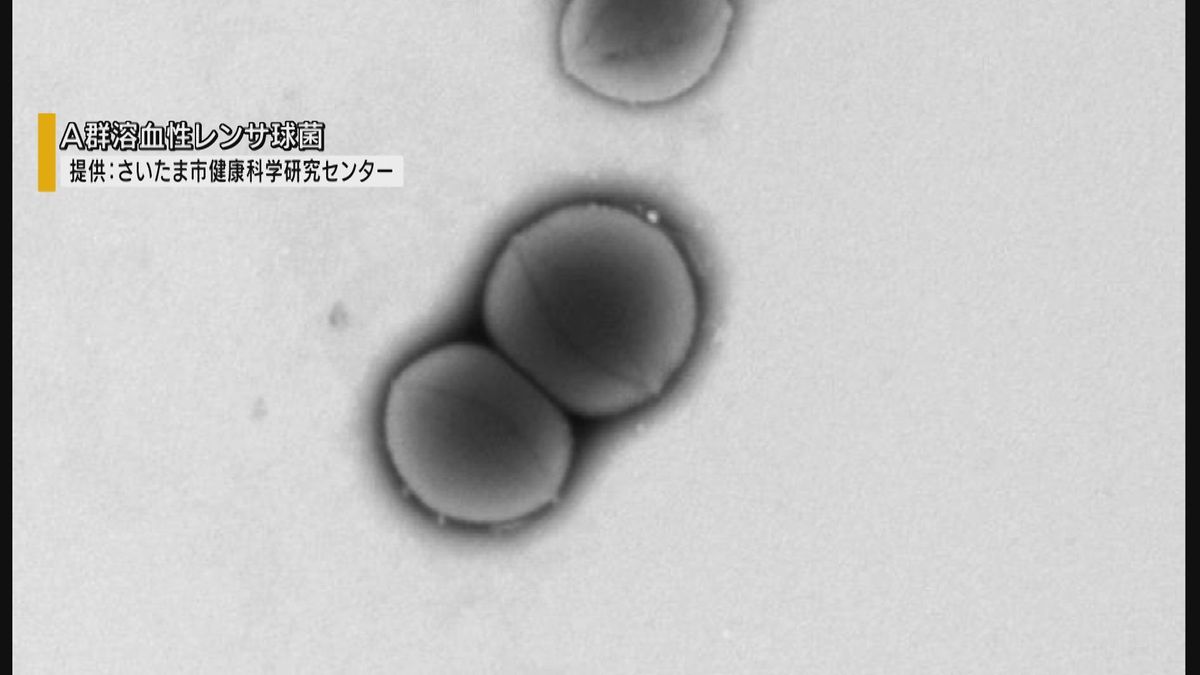 “人食いバクテリア” ことし感染7人のうち2人死亡 手洗いなど呼びかけ 山梨県