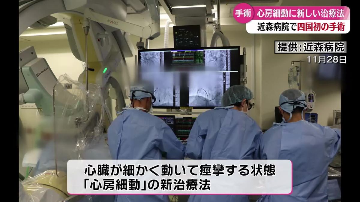 心房細動に対する新しい治療法 四国初となる手術が高知市で行われる【高知】