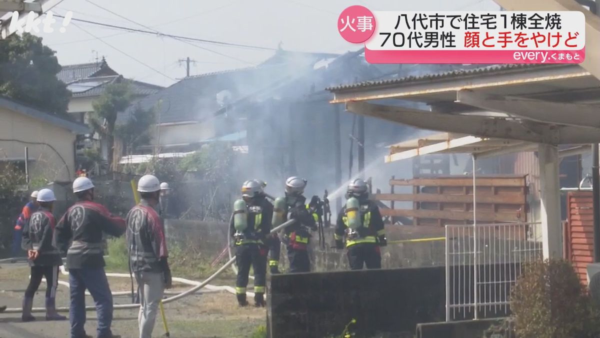 八代市で住宅火災 70代男性が顔や手にやけども命に別条なし