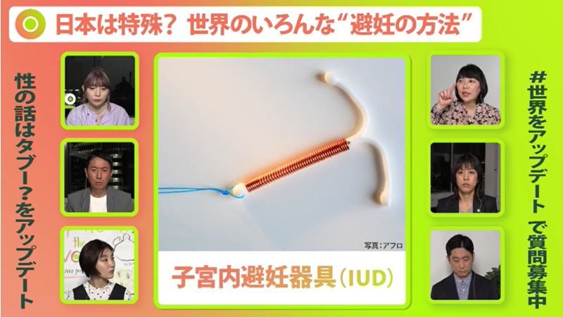 子宮内避妊器具（IUD）