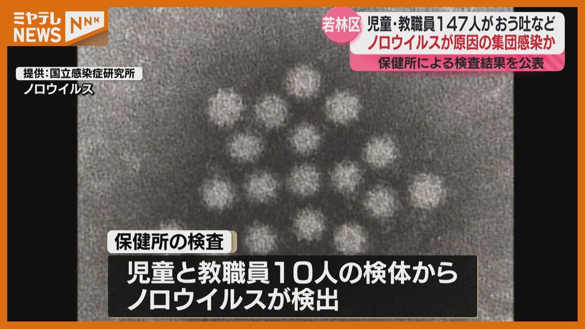 「ノロウイルス」による感染性胃腸炎の集団感染か…小学校で147人が嘔吐などの症状訴える（仙台市）