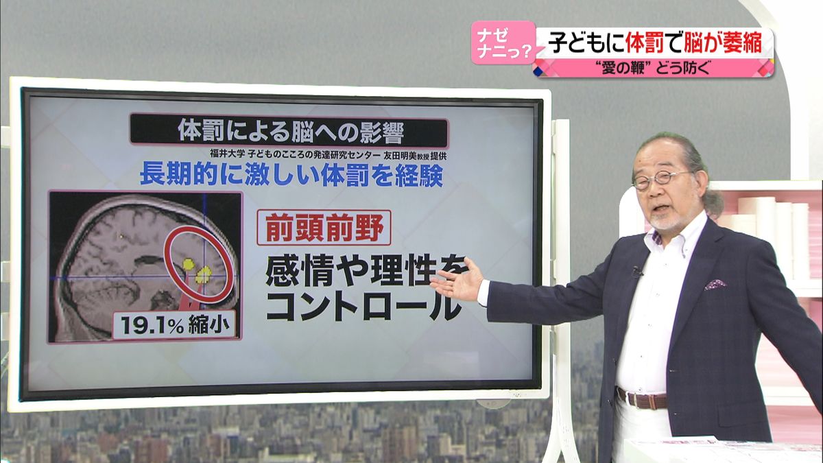 体罰で脳に悪影響…「愛の鞭」やめるには？