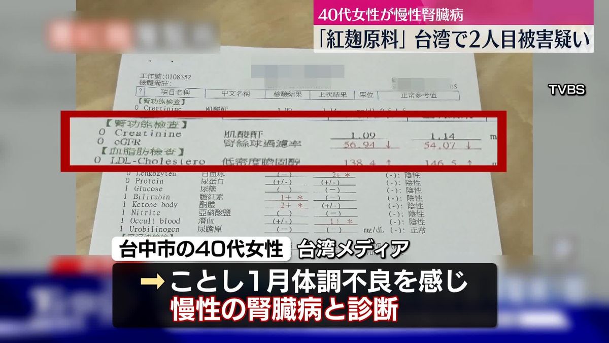 「紅麹原料」台湾で2人目被害疑い　40代の女性が腎臓病と診断