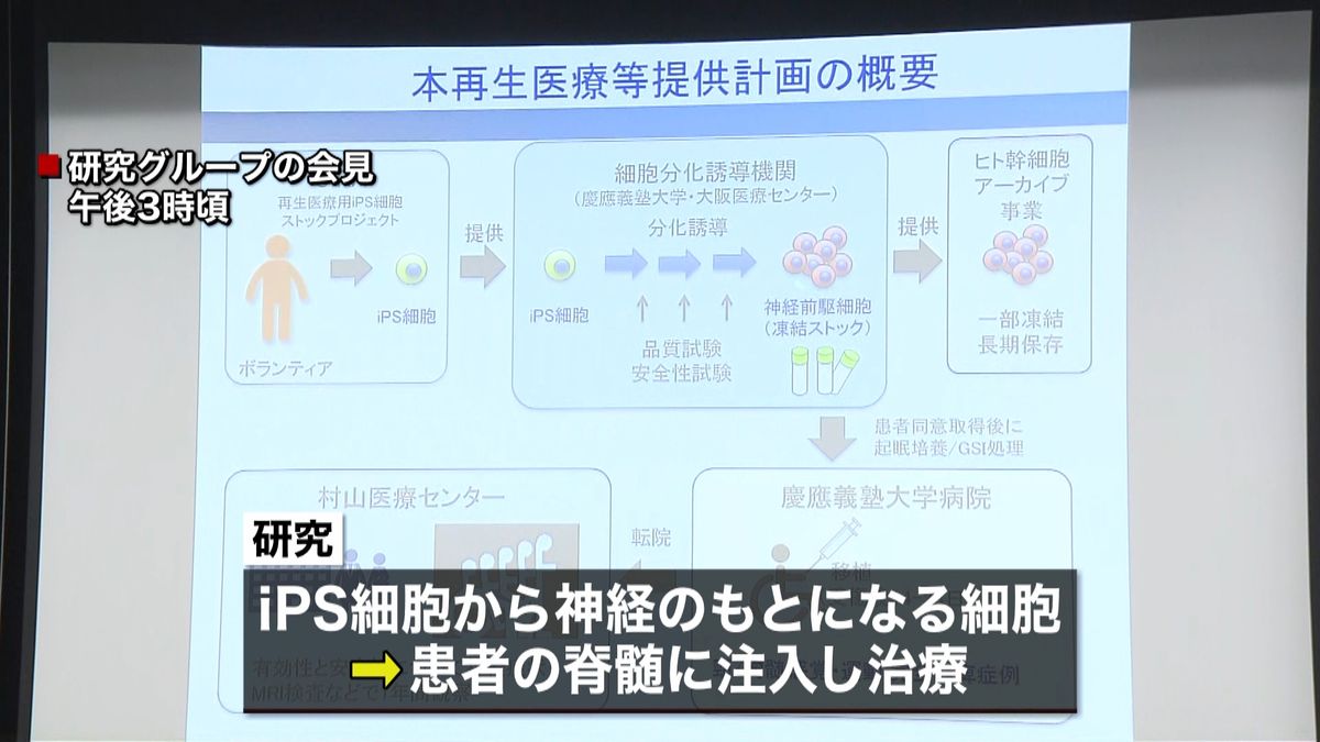 脊髄損傷で麻痺“ｉＰＳ細胞”で初の治療へ