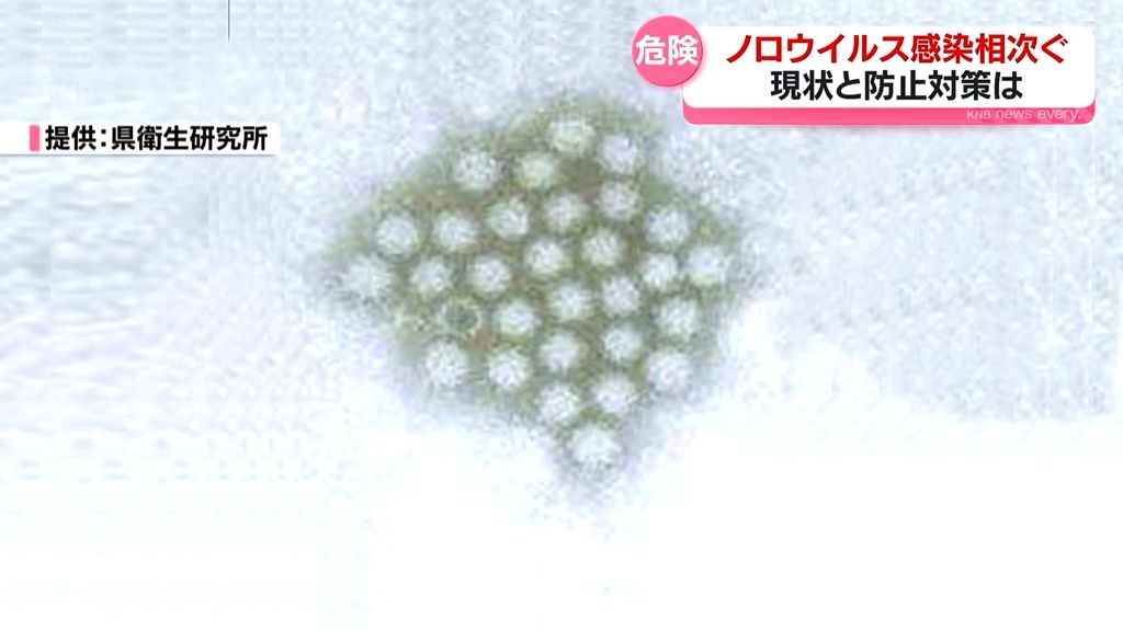 県内で死者も…ノロウイルス感染　防ぐためには