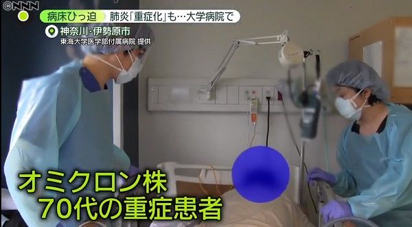 肺炎で「重症化」も…大学病院で