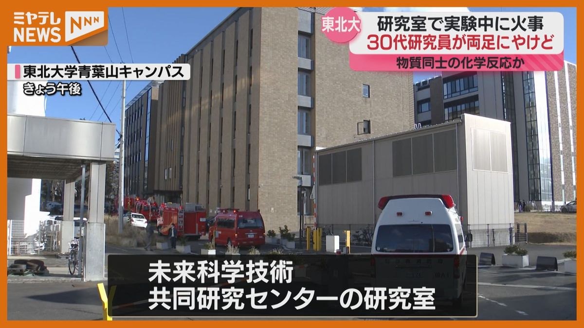 30代研究員が両足を火傷　東北大学青葉山キャンパスで火事「液体の薬品をこぼした」〈仙台市〉