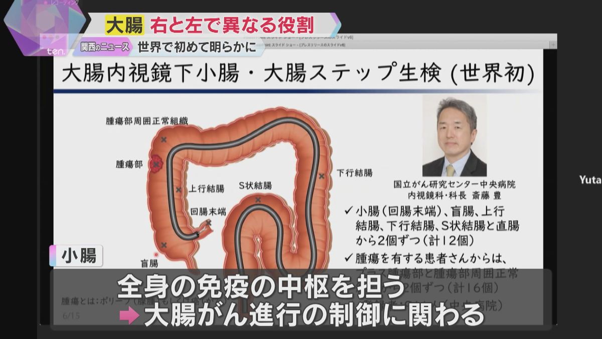 世界初！大腸が右側と左側で異なる役割があること明らかに　がんの新治療法の開発に期待　大阪大学など